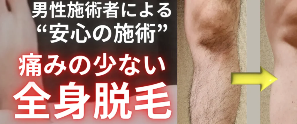 メンズ脱毛サロンMomona