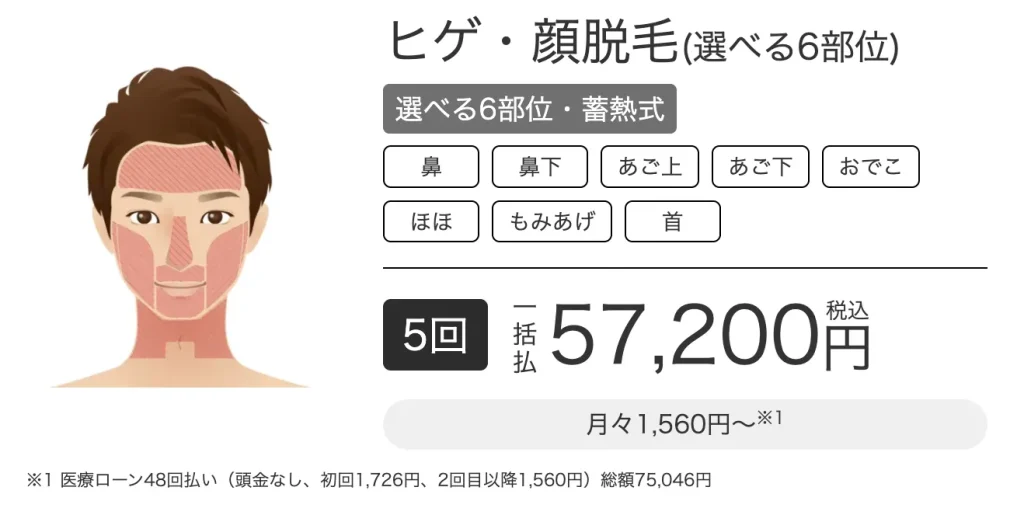 エミナルクリニックメンズのヒゲ脱毛6部位の部位別紹介と価格