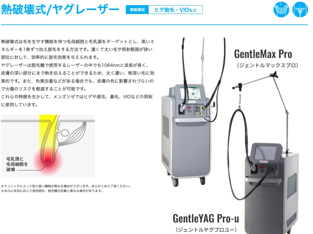 メンズリゼが導入している主要な脱毛機