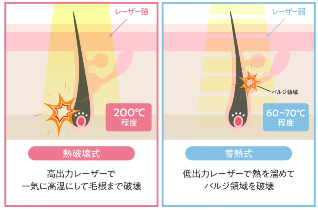 蓄熱式と熱破壊式の違い