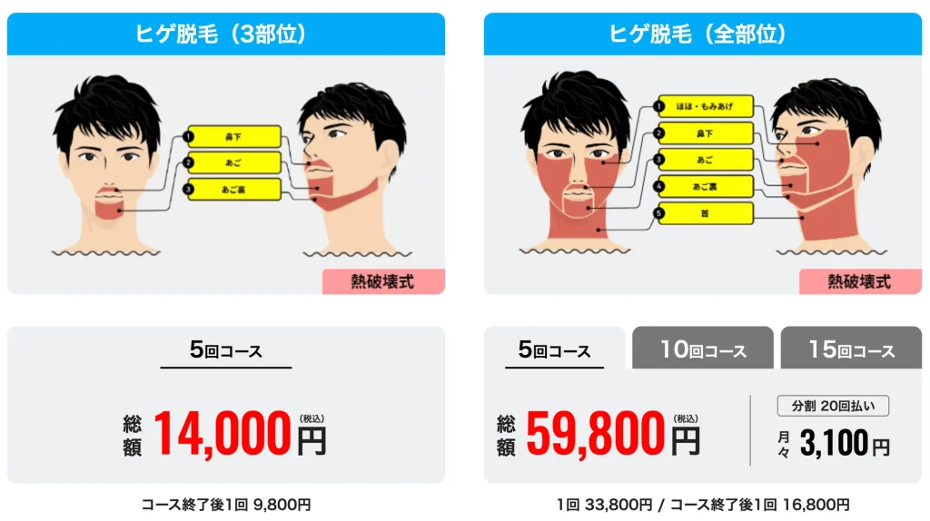 ヒゲ脱毛 主要プラン一覧