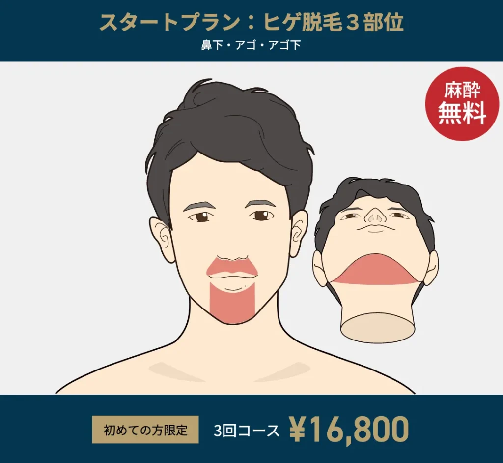 スタートプランの注意点