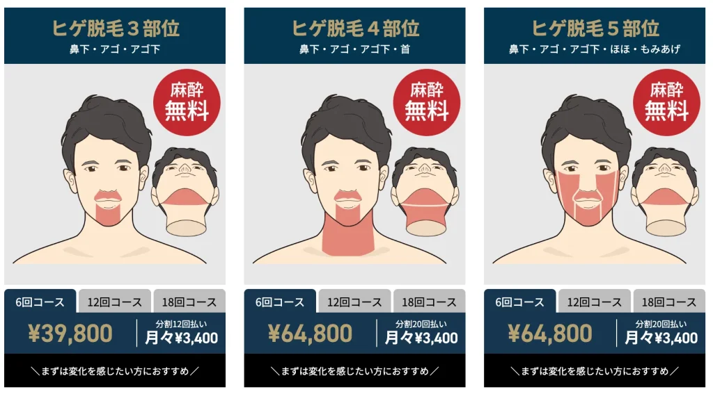 ゴリラクリニックのヒゲ脱毛 主要プラン一覧