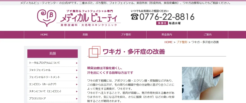 メディカルビューティ わきが