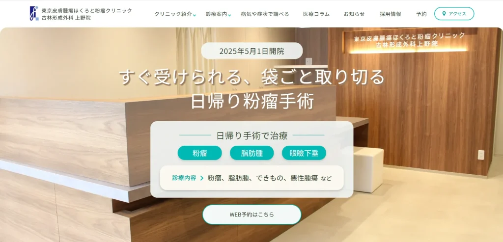 古林形成外科 上野院 わきが